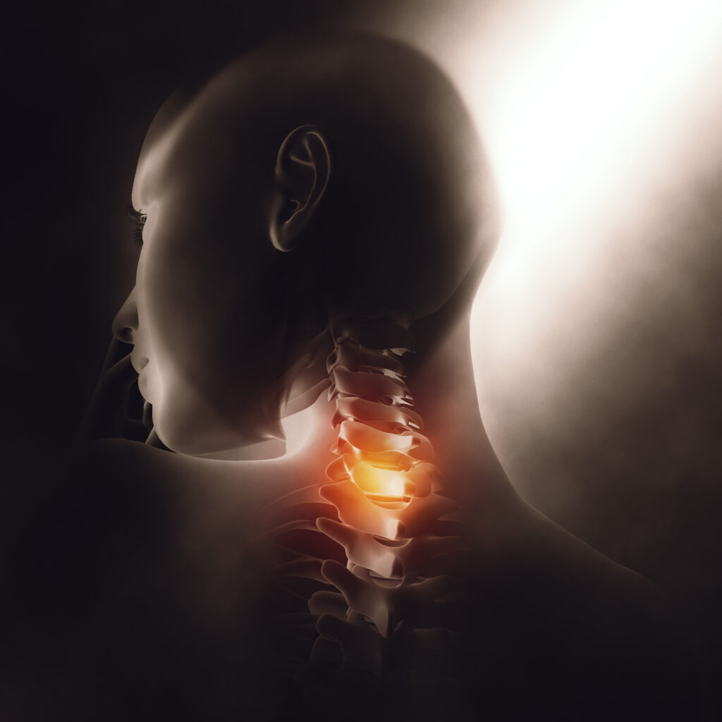 Dolor de cuello